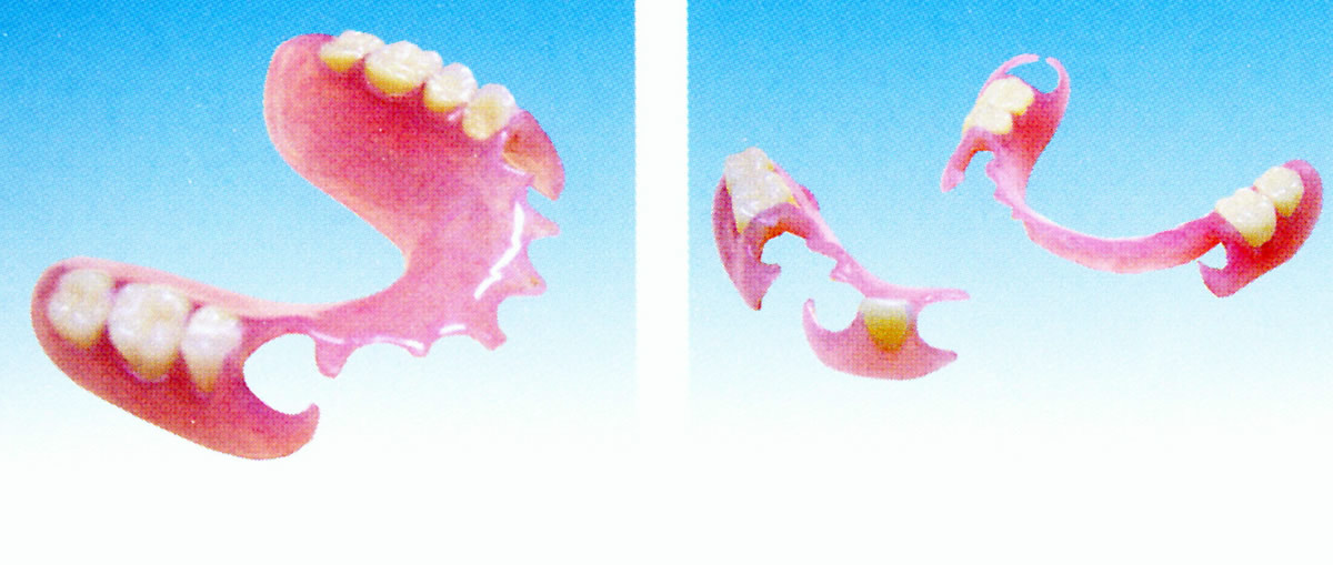 部分義歯（エステショット）